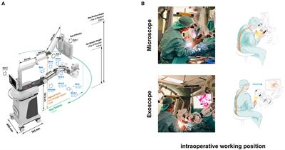 Evaluation of 3D Robotic-Guided Exoscopic Visualization in Microneurosurgery